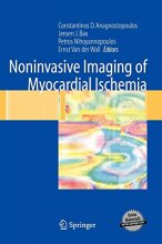 Cover art for Noninvasive Imaging of Myocardial Ischemia