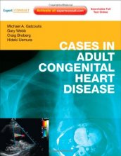 Cover art for Cases in Adult Congenital Heart Disease - Expert Consult: Online and Print: Atlas
