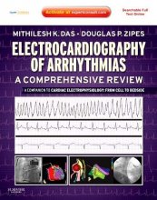Cover art for Electrocardiography of Arrhythmias: A Comprehensive Review: A Companion to Cardiac Electrophysiology