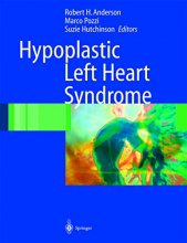 Cover art for Hypoplastic Left Heart Syndrome