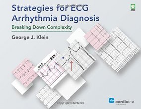 Cover art for Strategies for ECG Arrhythmia Diagnosis: Breaking Down Complexity