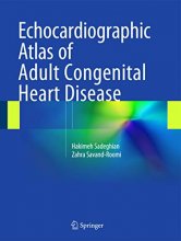 Cover art for Echocardiographic Atlas of Adult Congenital Heart Disease