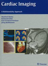 Cover art for Cardiac Imaging: A Multimodality Approach