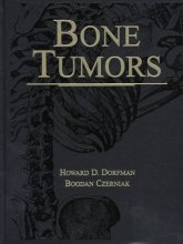 Cover art for Bone Tumors