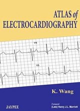 Cover art for Atlas of Electrocardiography