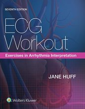 Cover art for ECG Workout: Exercises in Arrhythmia Interpretation