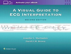 Cover art for A Visual Guide to ECG Interpretation