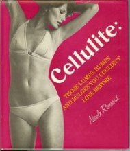 Cover art for Cellulite: those lumps, bumps, and bulges you couldn't lose before