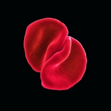 Cover art for Scratch My Back