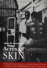 Cover art for Acres of Skin: Human Experiments at Holmesburg Prison