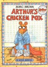 Cover art for Arthur's Chicken Pox: An Arthur Adventure (Arthur Adventure Series)