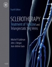 Cover art for Sclerotherapy: Treatment of Varicose and Telangiectatic Leg Veins, Text with DVD, 4e