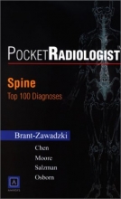 Cover art for PocketRadiologist - Spine: Top 100 Diagnoses, 1e