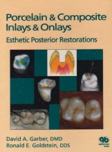 Cover art for Porcelain & Composite Inlays & Onlays: Esthetic Posterior Restorations