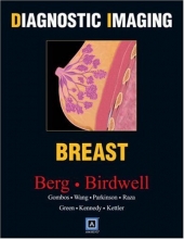 Cover art for Diagnostic Imaging: Breast, 1e