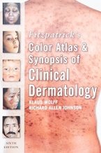 Cover art for Fitzpatrick's Color Atlas and Synopsis of Clinical Dermatology: Sixth Edition (Fitzpatrick's Color Atlas & Synopsis of Clinical Dermatology)