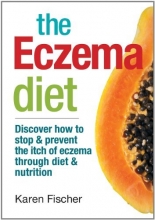 Cover art for The Eczema Diet: Discover How to Stop and Prevent The Itch of Eczema Through Diet and Nutrition
