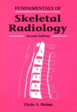 Cover art for Fundamentals of Skeletal Radiology