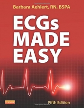 Cover art for Ecgs Made Easy