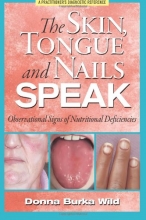 Cover art for The Skin, Tongue and Nails Speak: Observational Signs of Nutritional Deficiencies
