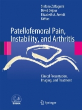Cover art for Patellofemoral Pain, Instability, and Arthritis: Clinical Presentation, Imaging, and Treatment