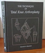 Cover art for The Technique of Total Knee Arthroplasty