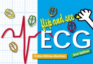 Cover art for Flip and See ECG