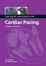 Cover art for The Nuts and Bolts of Cardiac Pacing 2nd Edition by Kenny, Tom (2008) Paperback