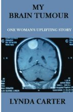 Cover art for My Brain Tumour: One Woman's Uplifting Story