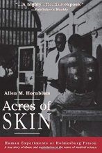 Cover art for Acres of Skin: Human Experiments at Holmesburg Prison