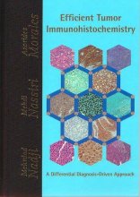 Cover art for Efficient Tumor Immunohistochemistry