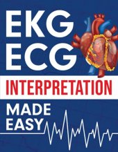 Cover art for EKG | ECG Interpretation Made Easy: An Illustrated Study Guide For Students To Easily Learn How To Read & Interpret ECG Strips