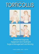 Cover art for Torticollis : Differential Diagnosis, Assessment, and Treatment, Surgical Management and Bracing (for Pediatrics)